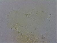 Echiniscus zetotrymus image