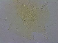 Echiniscus zetotrymus image