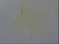 Echiniscus zetotrymus image