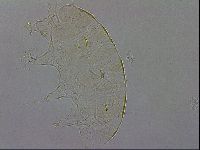 Echiniscus zetotrymus image