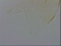 Echiniscus zetotrymus image