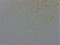 Echiniscus zetotrymus image