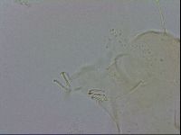 Echiniscus zetotrymus image