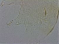 Echiniscus zetotrymus image
