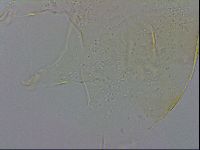 Echiniscus zetotrymus image