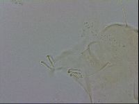 Echiniscus zetotrymus image