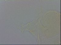 Echiniscus zetotrymus image