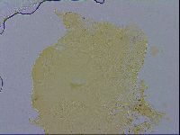 Echiniscus wendti image