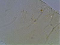 Echiniscus wendti image
