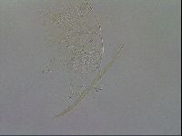 Echiniscus wendti image