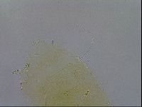Echiniscus wendti image