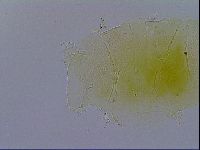 Echiniscus wendti image