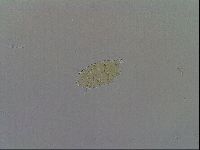 Echiniscus wendti image