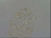 Testechiniscus laterculus image