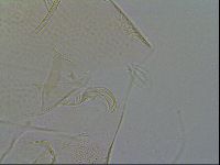 Testechiniscus laterculus image