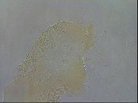 Testechiniscus laterculus image