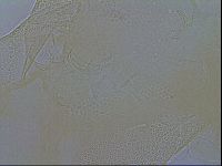 Testechiniscus laterculus image