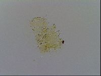 Testechiniscus laterculus image