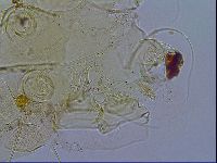 Testechiniscus laterculus image