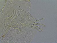 Testechiniscus laterculus image