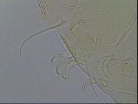 Testechiniscus laterculus image