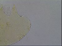 Testechiniscus laterculus image