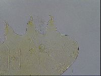 Testechiniscus laterculus image