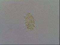 Testechiniscus laterculus image