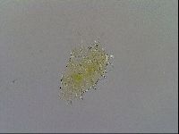 Testechiniscus laterculus image