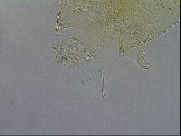 Testechiniscus laterculus image
