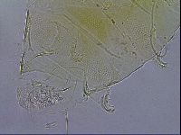 Testechiniscus laterculus image
