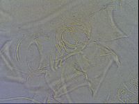 Testechiniscus laterculus image