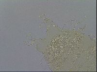 Testechiniscus laterculus image