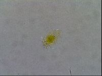 Testechiniscus laterculus image