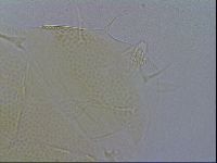 Testechiniscus laterculus image
