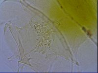 Testechiniscus laterculus image