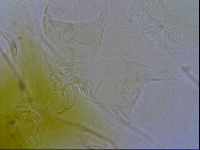 Testechiniscus laterculus image