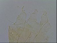 Testechiniscus laterculus image