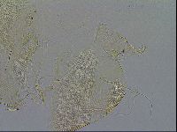 Testechiniscus laterculus image