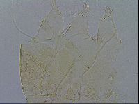Testechiniscus laterculus image