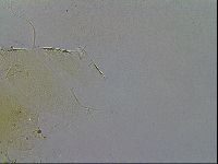 Testechiniscus laterculus image
