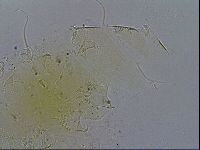 Testechiniscus laterculus image