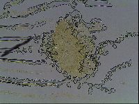 Testechiniscus laterculus image