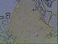 Testechiniscus laterculus image