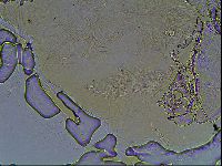 Testechiniscus laterculus image