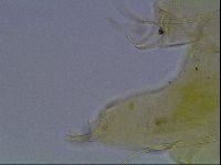 Testechiniscus laterculus image