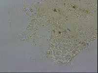 Testechiniscus laterculus image