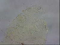 Testechiniscus laterculus image