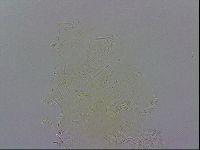 Testechiniscus laterculus image
