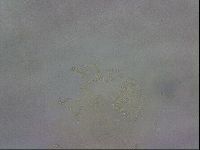 Testechiniscus laterculus image